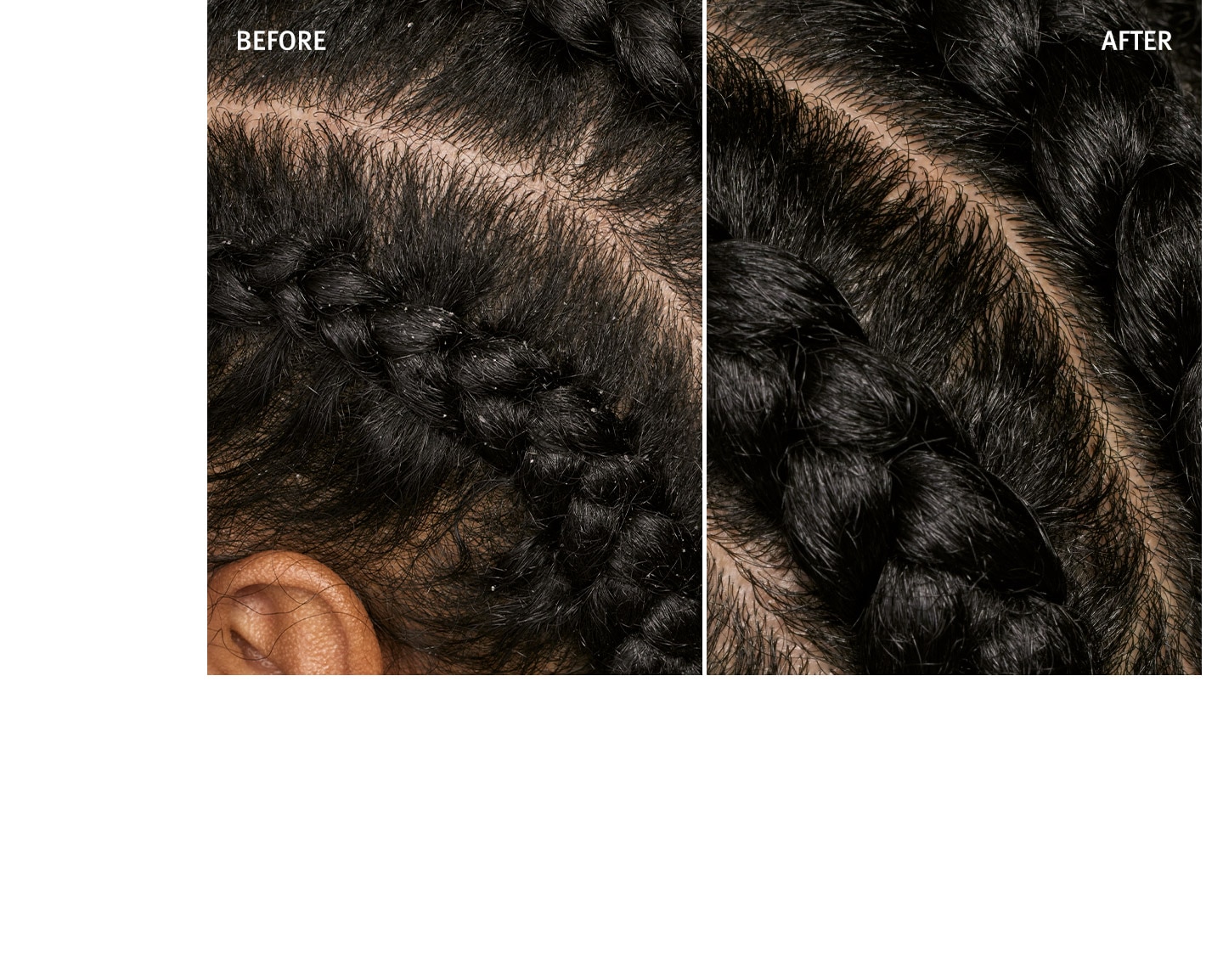 Observez la différence en utilisant la gamme scalp solutions